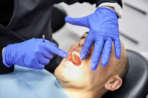 Best Emergency Tooth Extraction in Hyattsville, MD